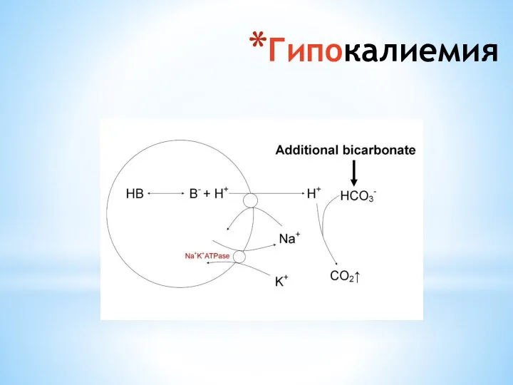 Гипокалиемия