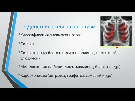 2.Действие пыли на организм Классификация пневмокониозов: Силикоз Силикатозы (асбестоз, талькоз, каолиноз‚