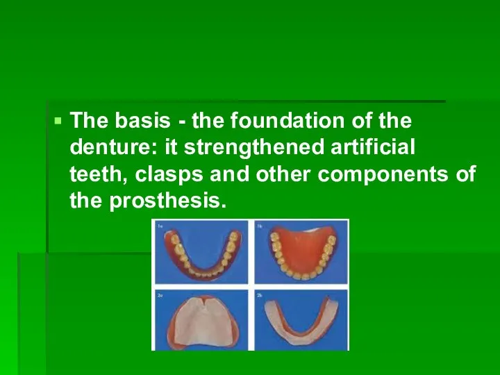 The basis - the foundation of the denture: it strengthened artificial