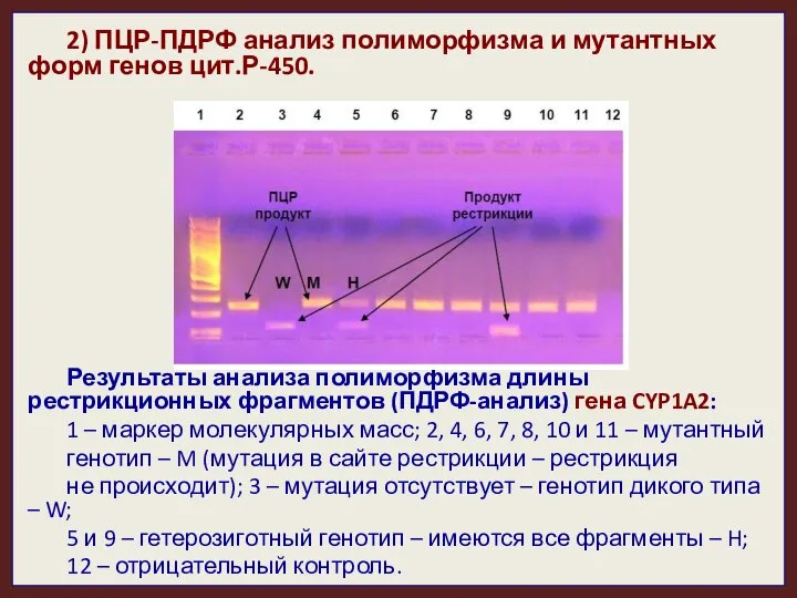 2) ПЦР-ПДРФ анализ полиморфизма и мутантных форм генов цит.Р-450. Результаты анализа