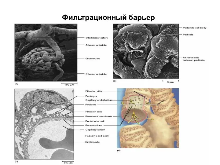 Фильтрационный барьер