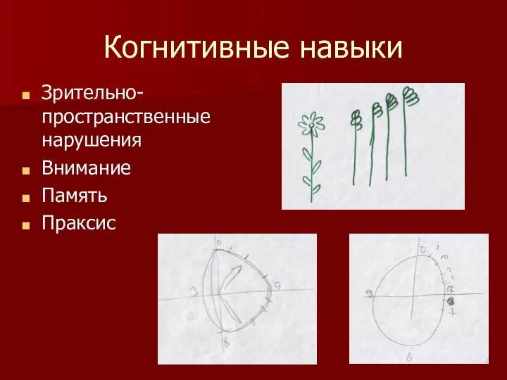 Когнитивные навыки Зрительно-пространственные нарушения Внимание Память Праксис