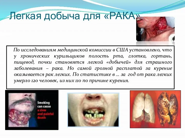 Легкая добыча для «РАКА» По исследованиям медицинской комиссии в США установлено,