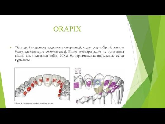 ORAPIX Тістердегі модельдер алдымен сканерленеді, содан соң әрбір тіс қатары бөлек