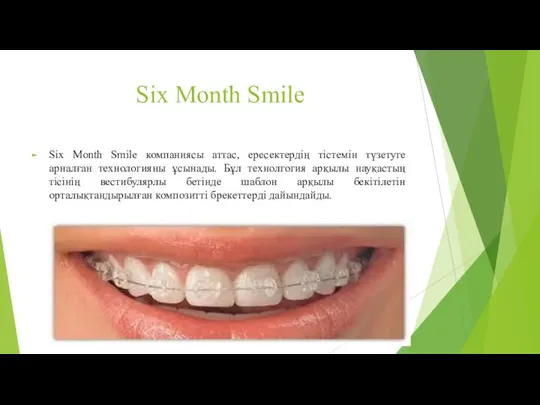 Six Month Smile Six Month Smile компаниясы аттас, ересектердің тістемін түзетуге