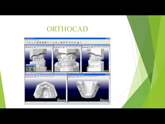 ORTHOCAD