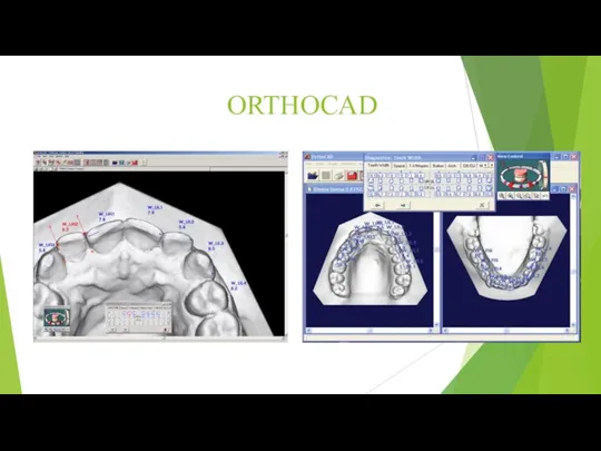 ORTHOCAD