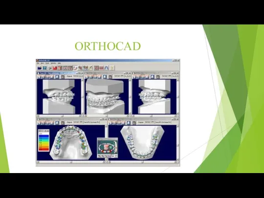 ORTHOCAD