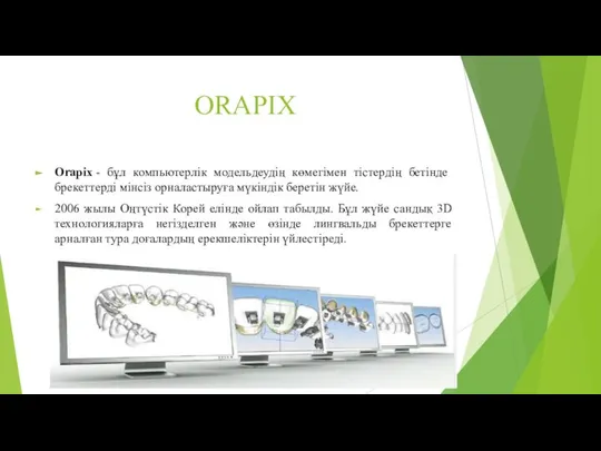 ORAPIX Orapix - бұл компьютерлік модельдеудің көмегімен тістердің бетінде брекеттерді мінсіз