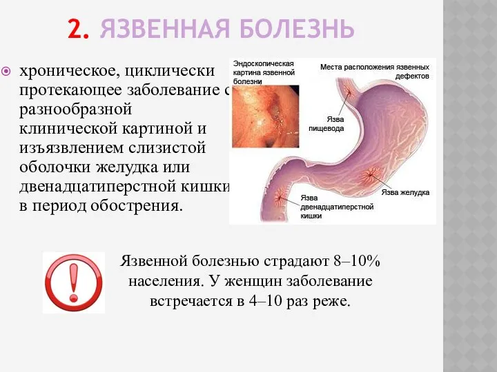 2. ЯЗВЕННАЯ БОЛЕЗНЬ хроническое, циклически протекающее заболевание с разнообразной клинической картиной