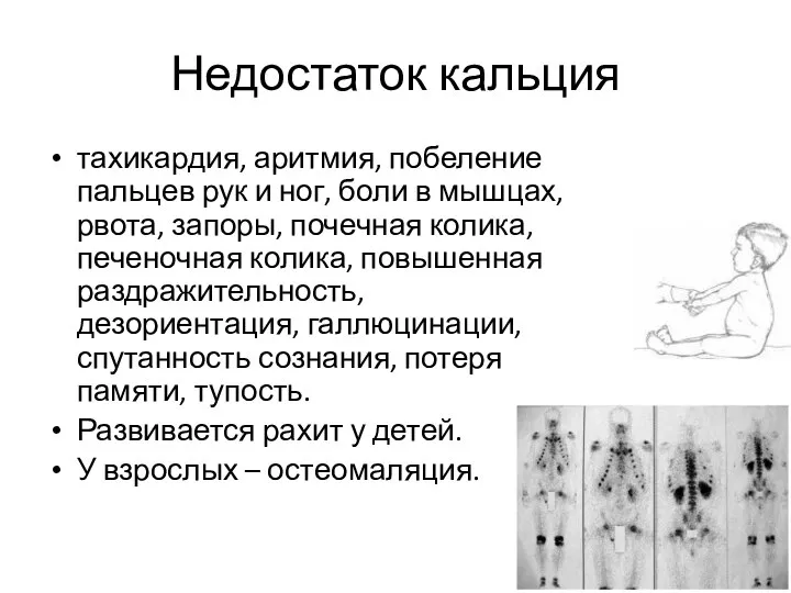 Недостаток кальция тахикардия, аритмия, побеление пальцев рук и ног, боли в