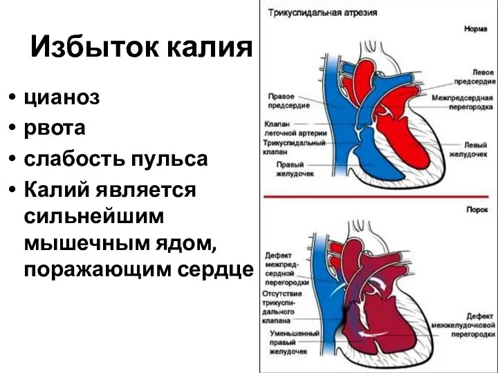 Избыток калия цианоз рвота слабость пульса Калий является сильнейшим мышечным ядом, поражающим сердце