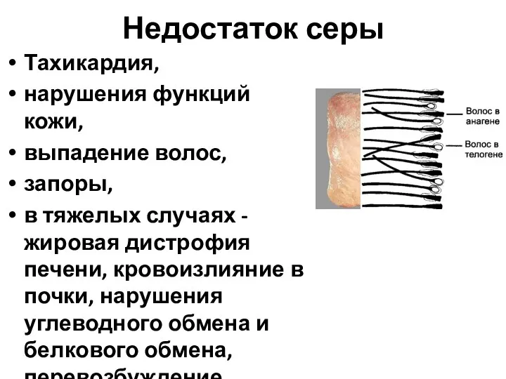 Недостаток серы Тахикардия, нарушения функций кожи, выпадение волос, запоры, в тяжелых