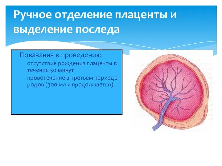 Ручное отделение плаценты и выделение последа Показания к проведению отсутствие рождения