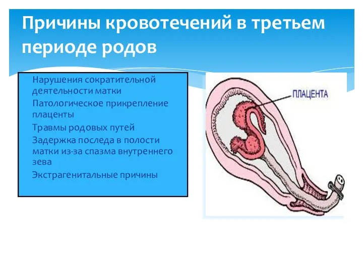 Причины кровотечений в третьем периоде родов Нарушения сократительной деятельности матки Патологическое