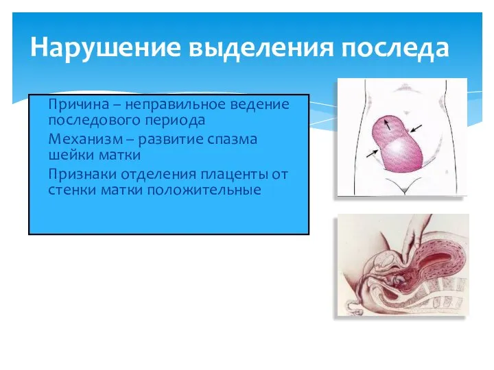 Нарушение выделения последа Причина – неправильное ведение последового периода Механизм –