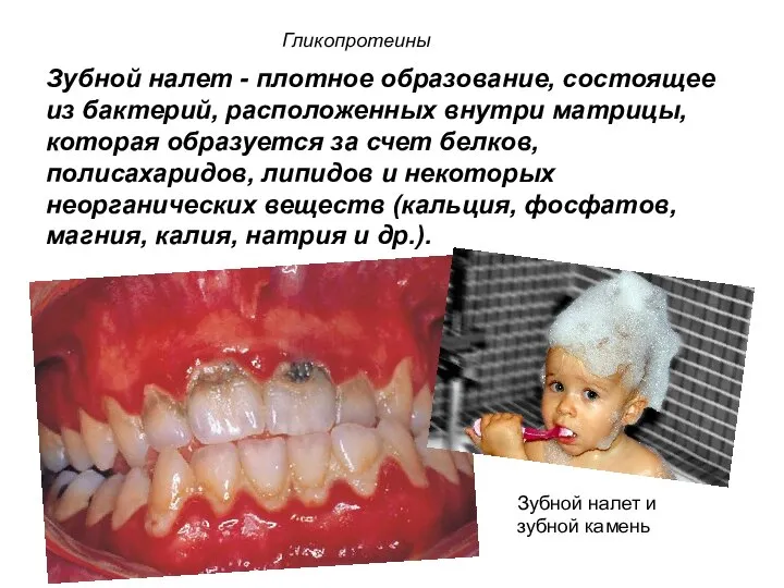 Зубной налет - плотное образование, состоящее из бактерий, расположенных внутри матрицы,