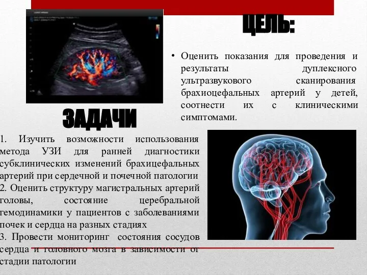 ЦЕЛЬ: ЗАДАЧИ 1. Изучить возможности использования метода УЗИ для ранней диагностики