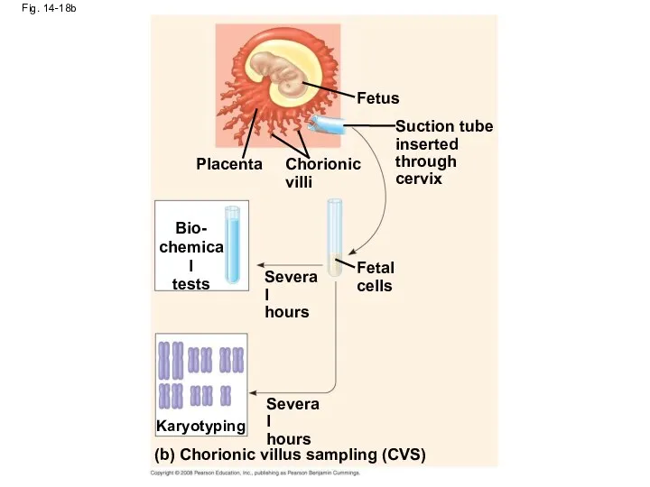 Fig. 14-18b (b) Chorionic villus sampling (CVS) Bio- chemical tests Placenta