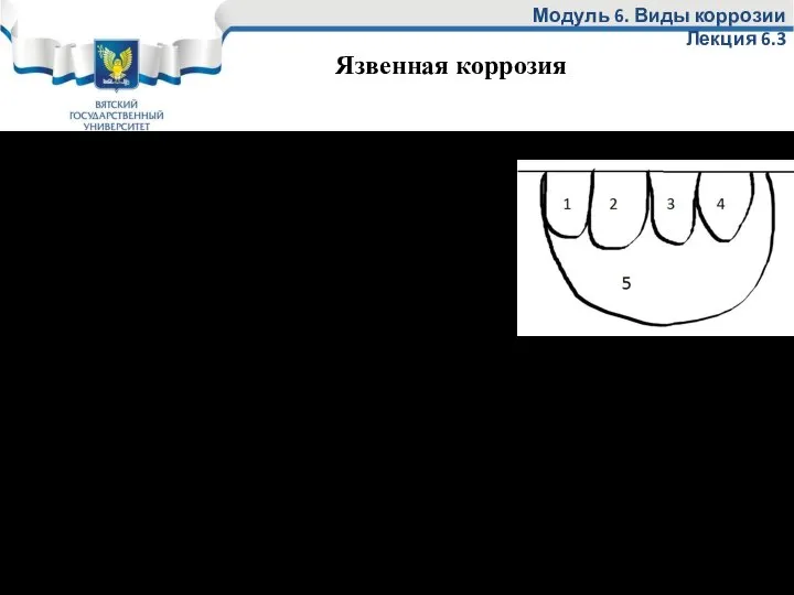 Язва (раковина) это большие образования. Часто бывает так – сначала образуются