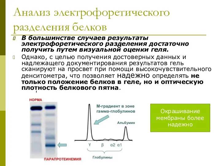 Анализ электрофоретического разделения белков В большинстве случаев результаты электрофоретического разделения достаточно