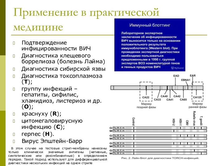 Применение в практической медицине Подтверждение инфицированности ВИЧ Диагностика клещевого боррелиоза (болезнь