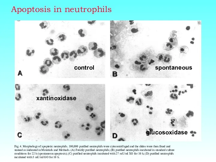 Apoptosis in neutrophils Fig. 4. Morphology of apoptotic neutrophils. 100,000 purified