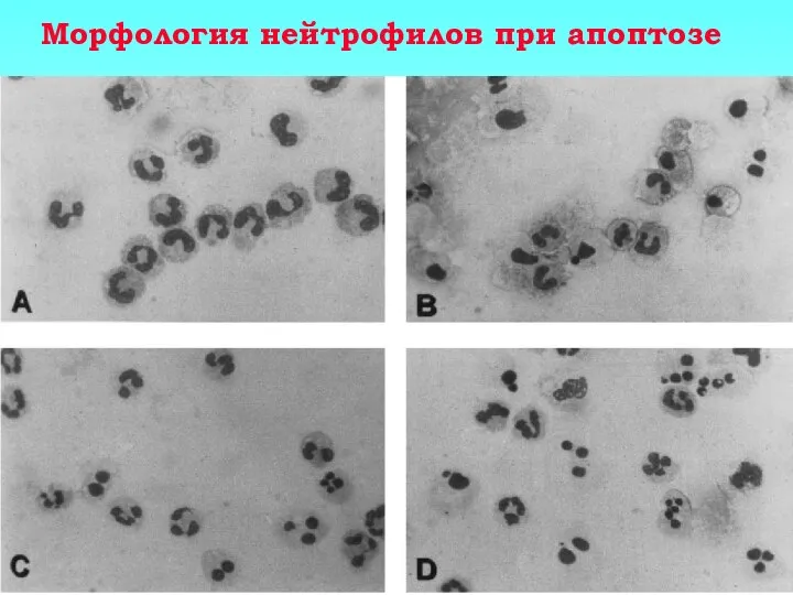 Морфология нейтрофилов при апоптозе