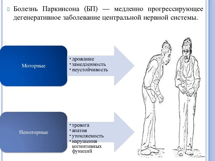 Болезнь Паркинсона (БП) — медленно прогрессирующее дегенеративное заболевание центральной нервной системы.