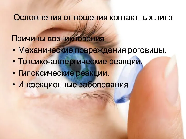Осложнения от ношения контактных линз Причины возникновения Механические повреждения роговицы. Токсико-аллергические реакции. Гипоксические реакции. Инфекционные заболевания