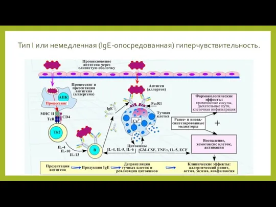 Тип I или немедленная (IgE-опосредованная) гиперчувствительность.