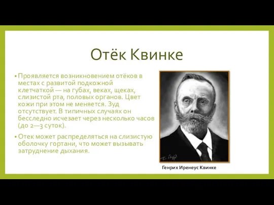 Отёк Квинке Проявляется возникновением отёков в местах с развитой подкожной клетчаткой