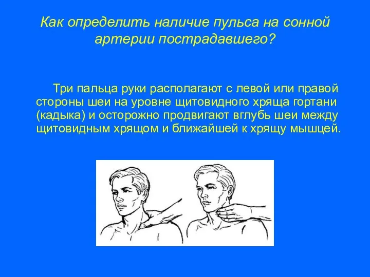 Как определить наличие пульса на сонной артерии пострадавшего? Три пальца руки