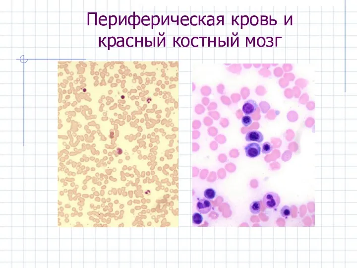 Периферическая кровь и красный костный мозг