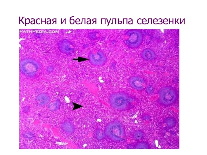 Красная и белая пульпа селезенки