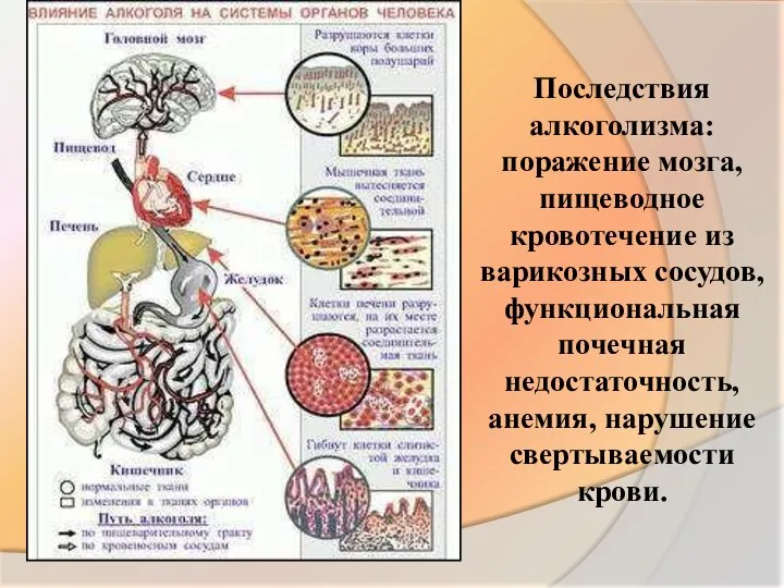 Последствия алкоголизма: поражение мозга, пищеводное кровотечение из варикозных сосудов, функциональная почечная недостаточность, анемия, нарушение свертываемости крови.