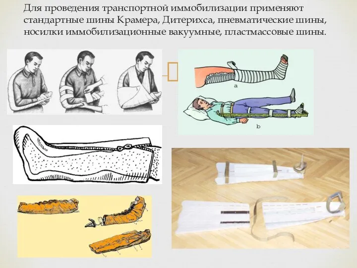 Для проведения транспортной иммобилизации применяют стандартные шины Крамера, Дитерихса, пневматические шины, носилки иммобилизационные вакуумные, пластмассовые шины.