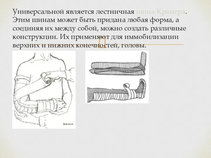 Универсальной является лестничная шина Крамера. Этим шинам может быть придана любая