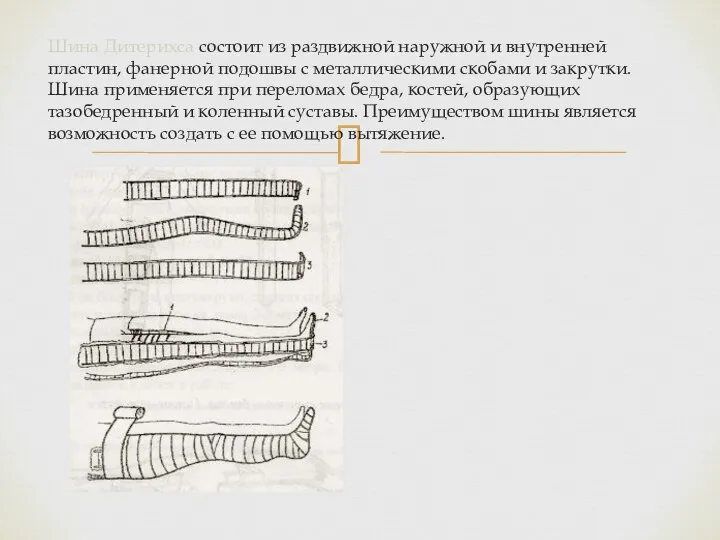 Шина Дитерихса состоит из раздвижной наружной и внутренней пластин, фанерной подошвы