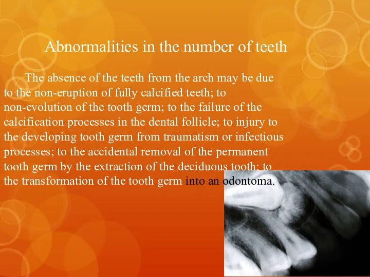 Abnormalities in the number of teeth The absence of the teeth