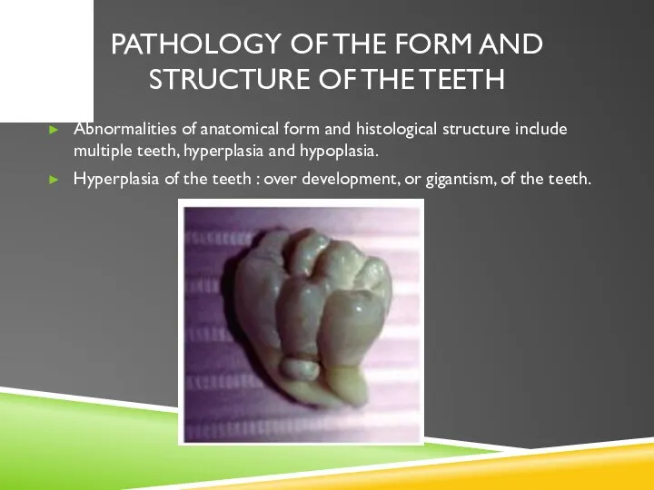 PATHOLOGY OF THE FORM AND STRUCTURE OF THE TEETH Abnormalities of