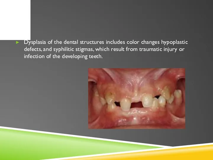 Dysplasia of the dental structures includes color changes hypoplastic defects, and