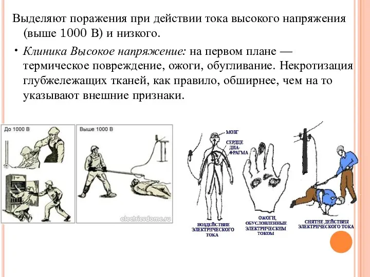 Выделяют поражения при действии тока высокого напряжения (выше 1000 В) и