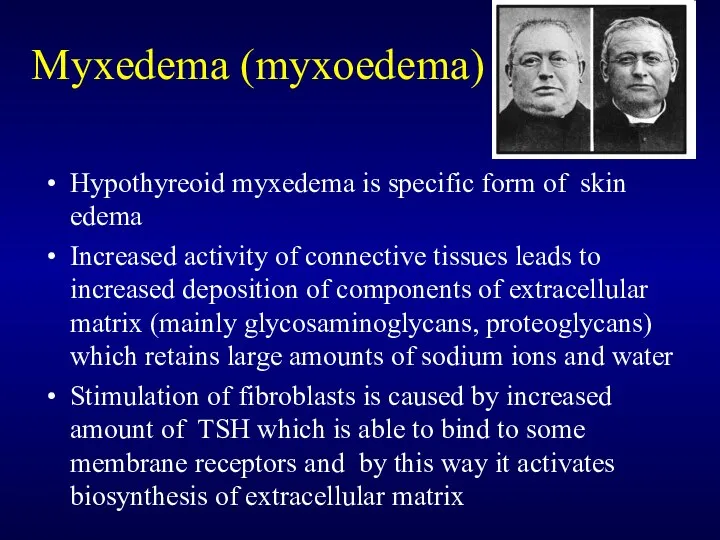 Myxedema (myxoedema) Hypothyreoid myxedema is specific form of skin edema Increased