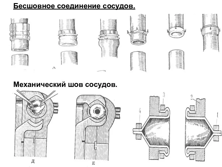 Бесшовное соединение сосудов. Механический шов сосудов.