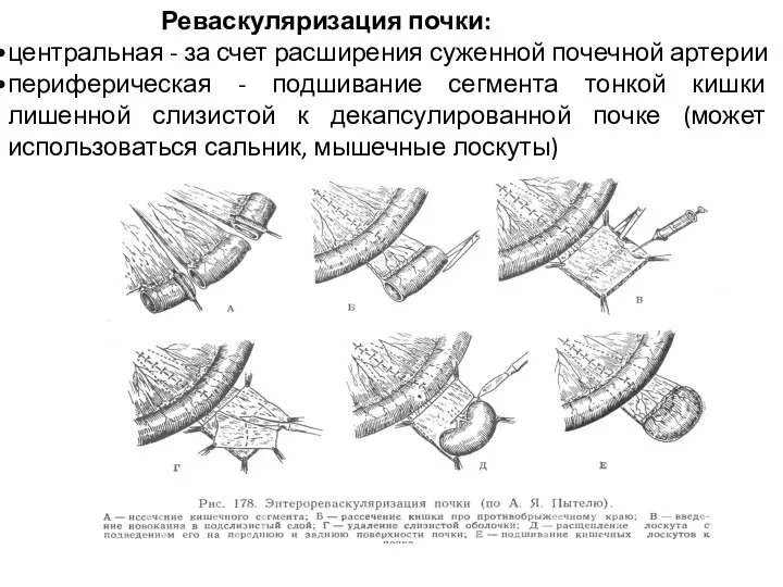 Реваскуляризация почки: центральная - за счет расширения суженной почечной артерии периферическая