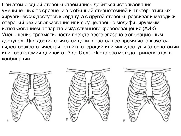 При этом с одной стороны стремились добиться использования уменьшенных по сравнению