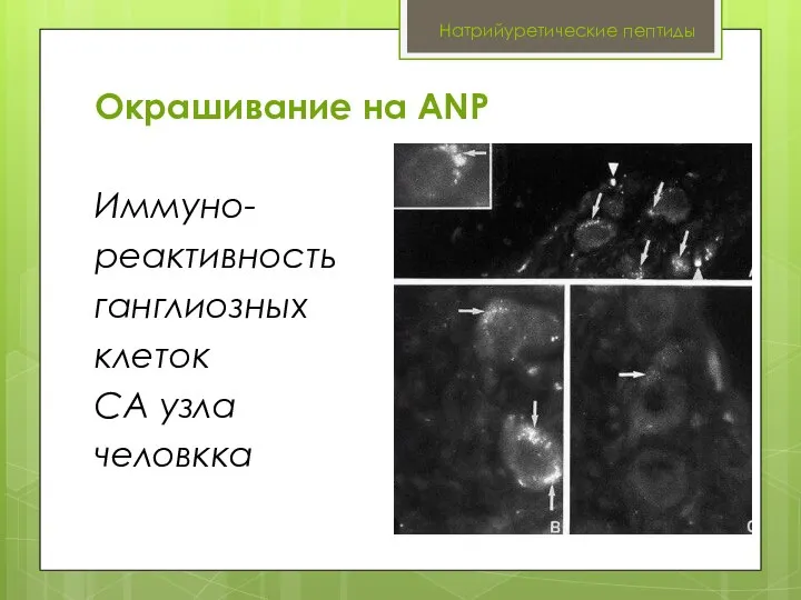 Натрийуретические пептиды Окрашивание на ANP Иммуно- реактивность ганглиозных клеток СА узла человкка