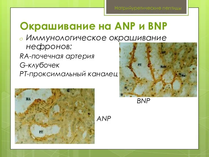 Натрийуретические пептиды Окрашивание на ANP и BNP Иммунологическое окрашивание нефронов: RA-почечная