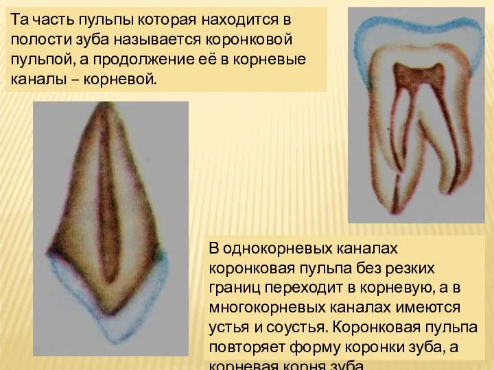 Та часть пульпы которая находится в полости зуба называется коронковой пульпой,